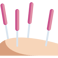 Acupoints on skin with needles during acupuncture treatment.