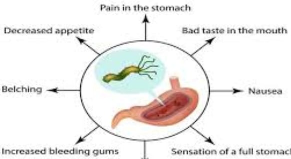 _What are the first symptoms of H. pylori