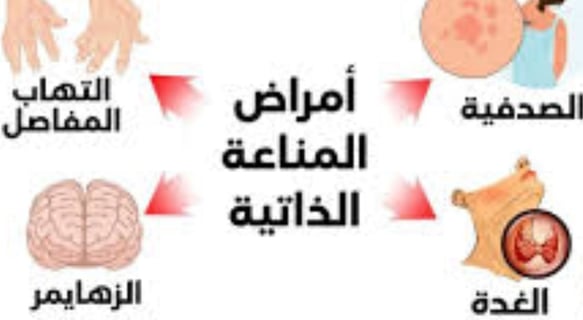 امراض المناعة الذاتية