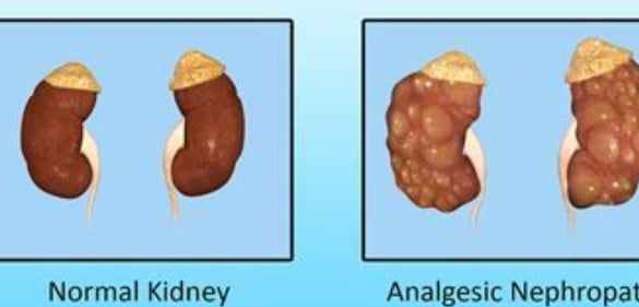 nephropathy