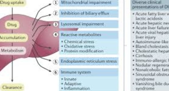 fatty liver disease drug induced