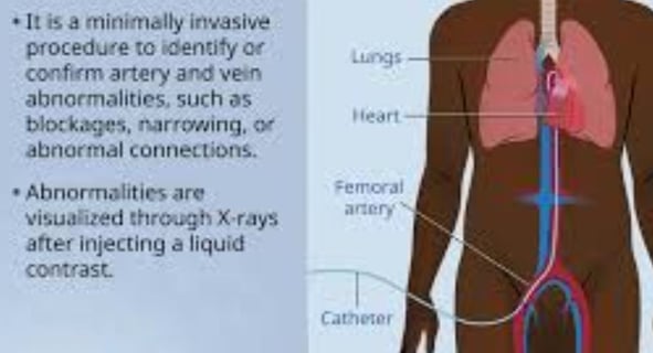 Cardiac Catheterization Why Every Case Is Followed by a Stent