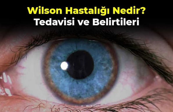 Vücuttaki bakır seviyelerini ölçerek Wilson hastalığı ve diğer sağlık durumlarını değerlendirmeye yardımcı olur.