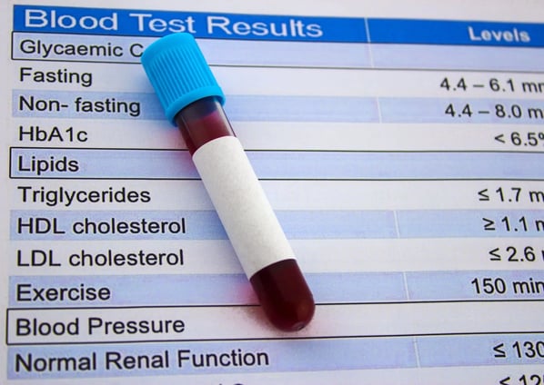 C-Peptid testi, pankreasın insülin üretme kapasitesini değerlendiren önemli bir kan testidir.