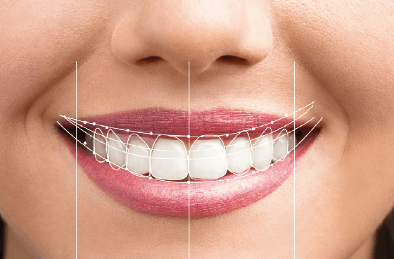 Best Dental Scaling and Polishing Service in Pune