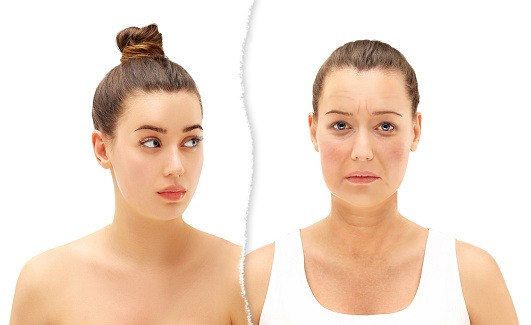 dermal fillers