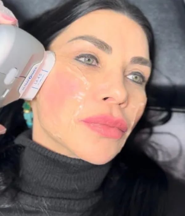 Sessão de tratamento corporal Ultraformer
