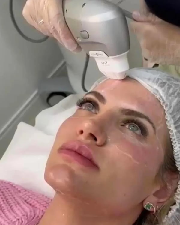 Cliente Ultraformer Paulista satisfeita com o resultado