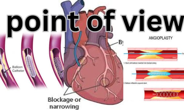 Heart Bypass, point of view