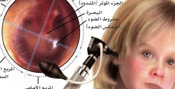 منظار