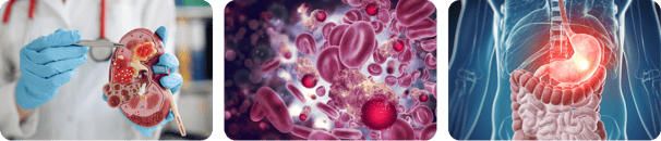 Kidney, blood and stomach cancer treatments by Dr.Runu Sharma, expert Oncologist at Uttarakhand
