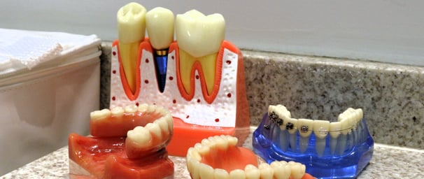 a toothbrush and dental care products on a counter