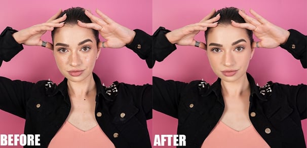 Blemishes and other imperfections removal