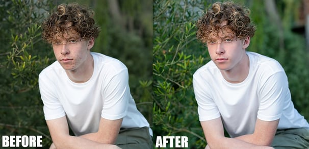 Blemishes and scars Removal