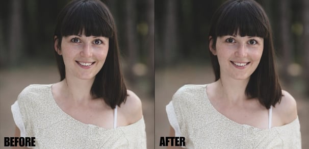 eye-correction