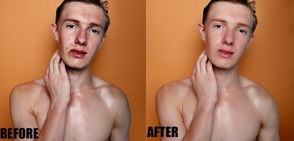 High-end Skin Retouching Before and After 