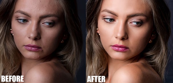 Skin Refinement
