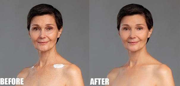 Remove Wrinkles Before and After