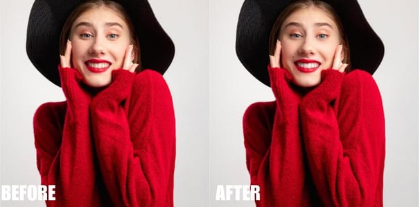 teeth-whitening-and-eye-enhancement