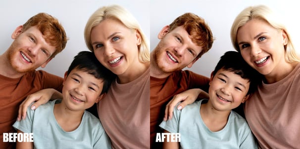 basic-skin-retouching