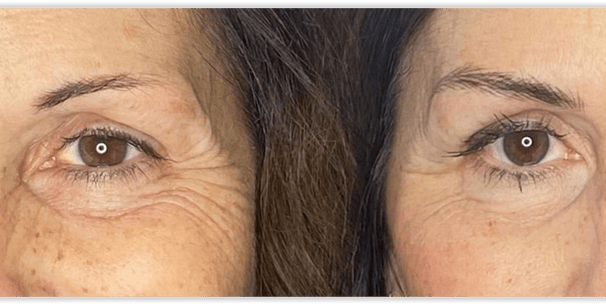 Trucco semipermanente sopracciglia Pelo realistioco. Confronto prima e dopo.