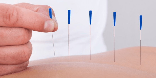 Dr. Leonardo Campos - Acupuntura em Salvador