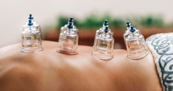 best Cupping Therapy In Kerala