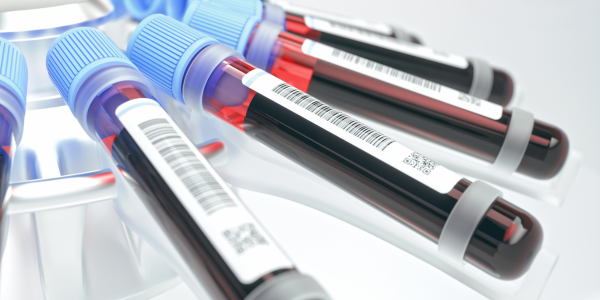 a group of blood test tubes with blood samples