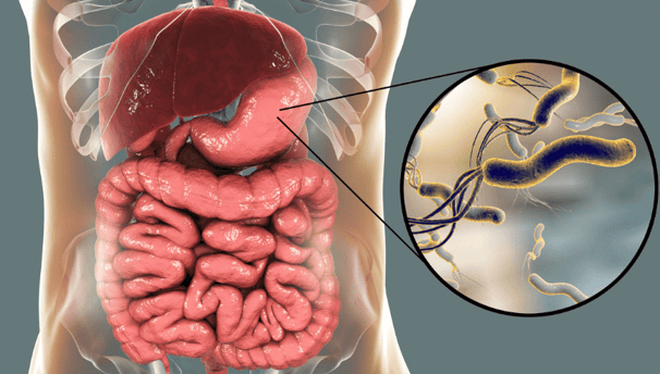 Helikobakter Pylori testi, mide enfeksiyonlarının teşhisinde kullanılan önemli bir tanı yöntemidir