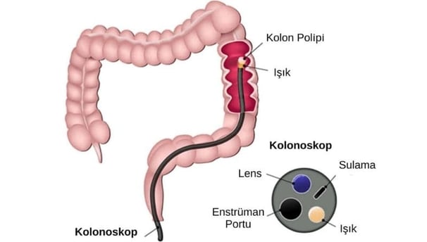 Kolonoskopi, bağırsak hastalıklarının teşhisinde kullanılan önemli bir görüntüleme yöntemidir.