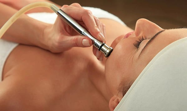 Anwendung von Microdermabrasion an einer Frau