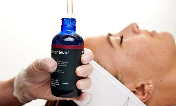 Pipette einer Flüssigkeit zur Fruchtsäurebehandlung
