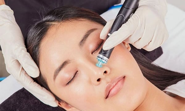 HydraFacial Behandlung an einer Frau