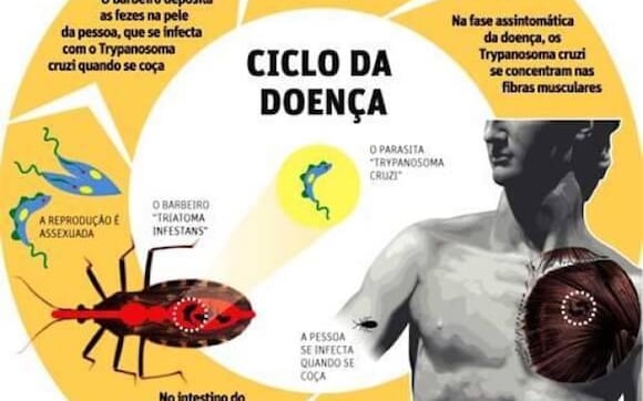 Doença de Chagas