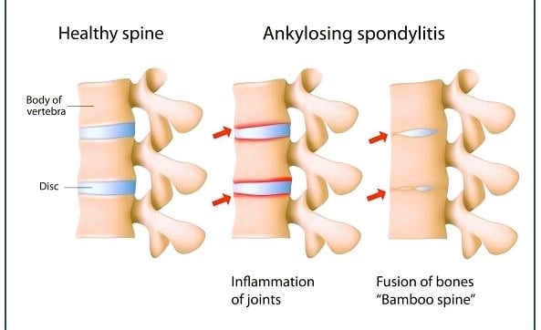 a diagram of a healthy spiner spiner