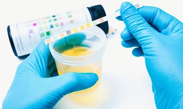 urine in lab