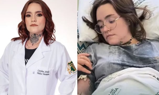 Espondiloartrite Axial e Neuralgia do Trigêmeo: A Luta de Carolina Arruda Contra a "Pior Dor do Mundo"