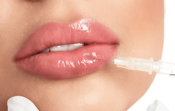 a woman is getting her lips brushed with a needle - tipped needle