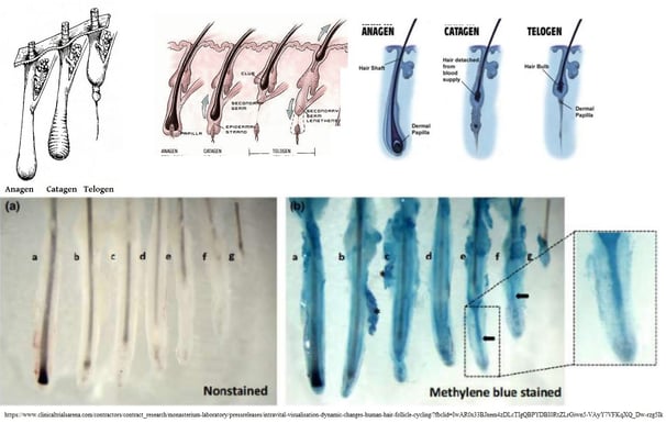 human-hair-growth-cycle
