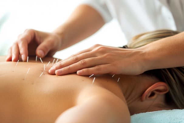 a woman getting acupied with acupress needles