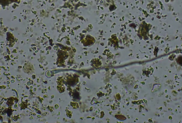 Soil Microbes under the microscope