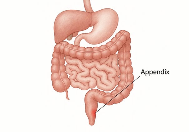 Medical illustration of the human digestive system highlighting the appendix in red, located in the 