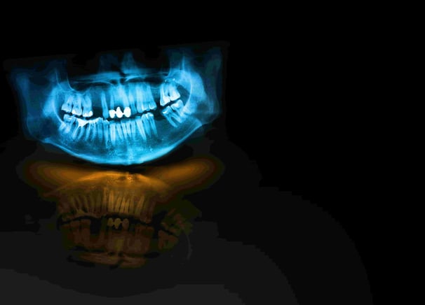 panoramic x-ray