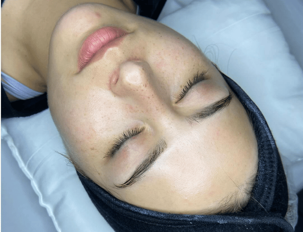 limpieza facial