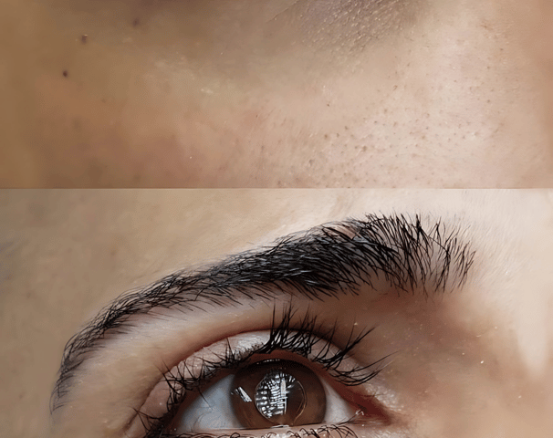 Micropigmentación de Ojeras