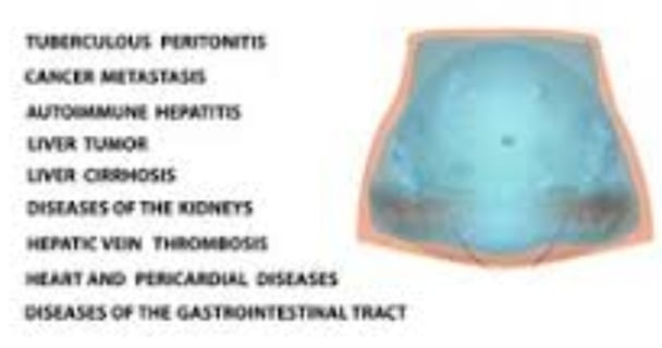 causes of ascitis