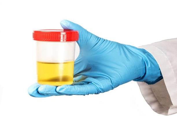 Urinary Tract Infection, Burning, Pee, Urine, Frequency, Antibiotics, Tests, Testing, UTI