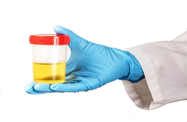 Urinary Tract Infection, Burning, Pee, Urine, Frequency, Antibiotics, Tests, Testing, UTI