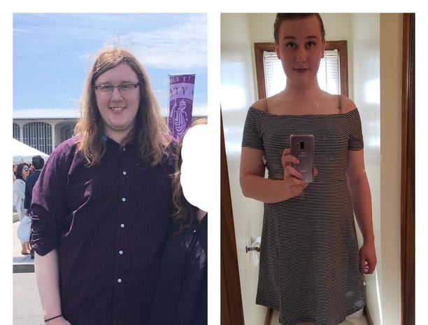 tirzepatide weight lose
