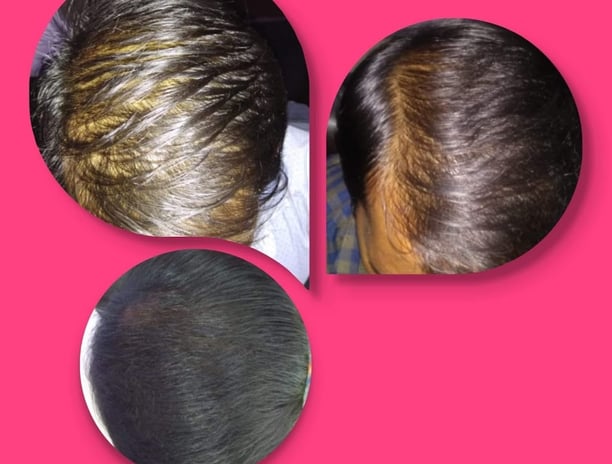 Skindent's Rejuvenate Trichology Services Hair